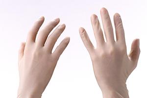 成城で歯周病の治療を受けてみよう