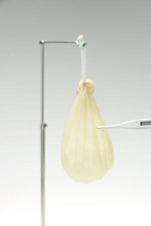 豊島区の矯正歯科で歯並びを改善